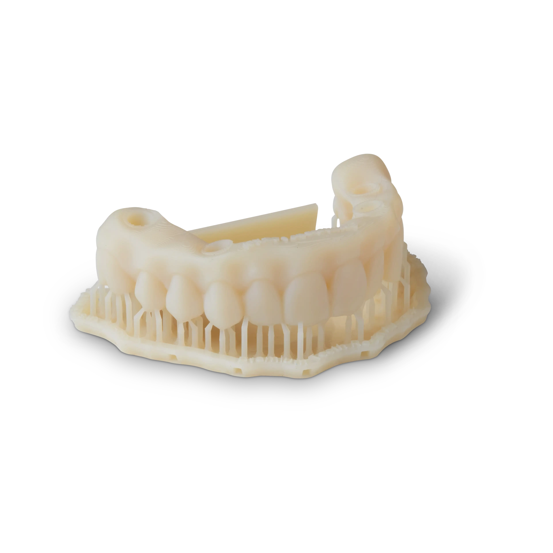 In-house 3D printer producing a custom dental arch for All-on-X treatment